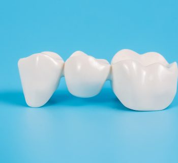 Advantages and Disadvantages of Dental Bridges to Replace Missing Teeth